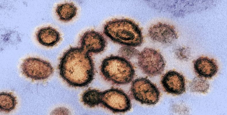 Imagen obtenida con  microscopio electrónico  y divulgada el 27 de febrero de 2020 por los Institutos Nacionales de Salud de Estados Unidos, muestra al virus S