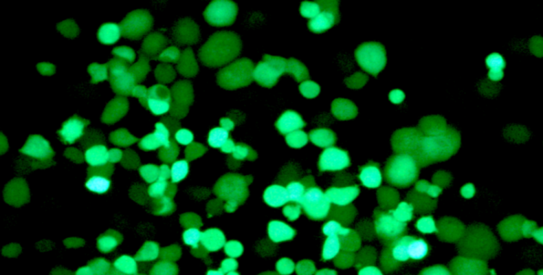 Células tumorales infectadas por el virus (fluorescente) cinco días después de la infección. Idibaps e IRB Barcelona