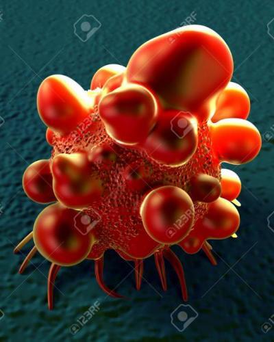 Ilustración de una célula de cáncer intestinal.Foto:Internet.