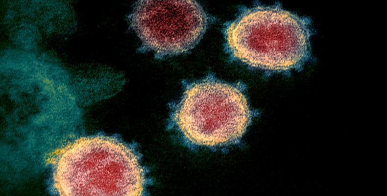 Partículas del virus SARS-CoV-2 emergiendo de la superficie de células cultivadas en el laboratorio.NIAID-RML / Reuters