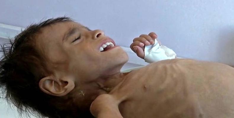 UN report show Yemeni child dies every 10 minutes from war-caused disease, hunger.  Photo: Reuters