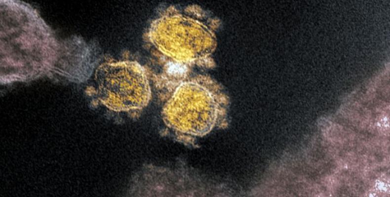 Imagen a color del coronavirus en un microscopio electrónico de transmisión. (NIAID vía The New York Times)