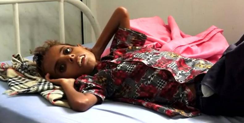 U.S.-backed assault on Yemen threatens supplies to millions facing famine.  Photo: AP