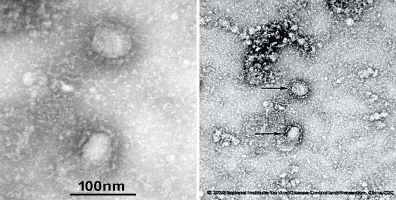 Coronavirus denominado 2019-nCoV. Foto / Instituto de Microbiología de la Academia de Ciencias de China