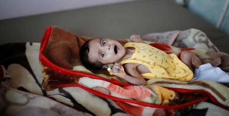 Yemeni children suffering with cholera.  Photo: AFP