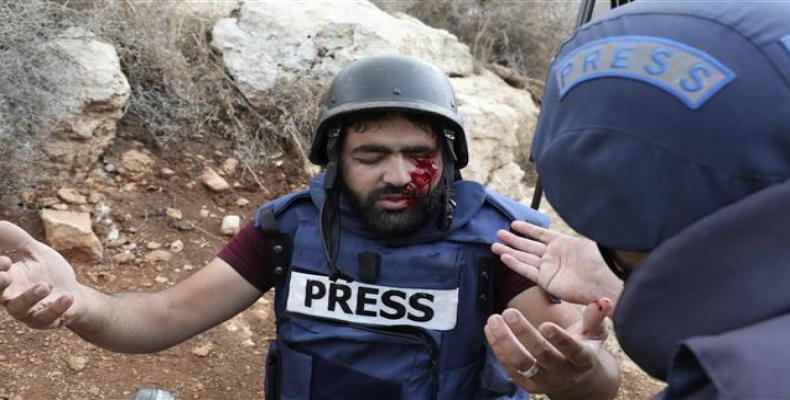 Palestinian photojournalist Moaz Amarneh was hit on the face by a rubber bullet from Israeli police.  (Photo: AFP)