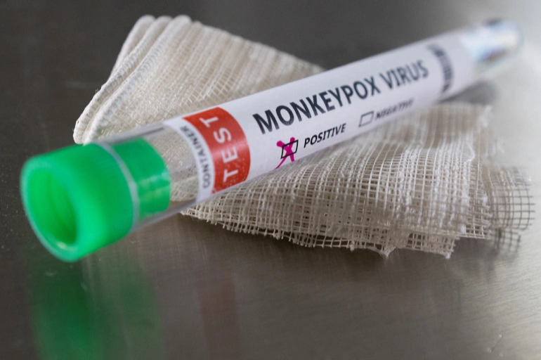 WHO asks public for help with Monkeypox name change