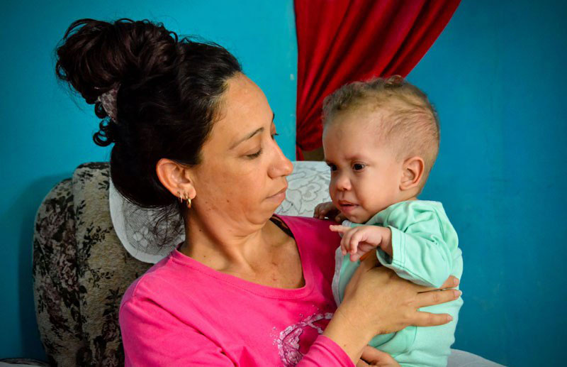 programa de atención a niños postrados 